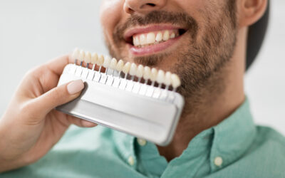 Carillas dentales: ¿porcelana o composite?